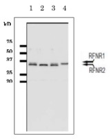 FNR | Ferredoxin NADP Reductase (root) in the group Antibodies Plant/Algal / Photosynthesis / Electron transfer at Agrisera AB (Antibodies for research) (AS20 4436)